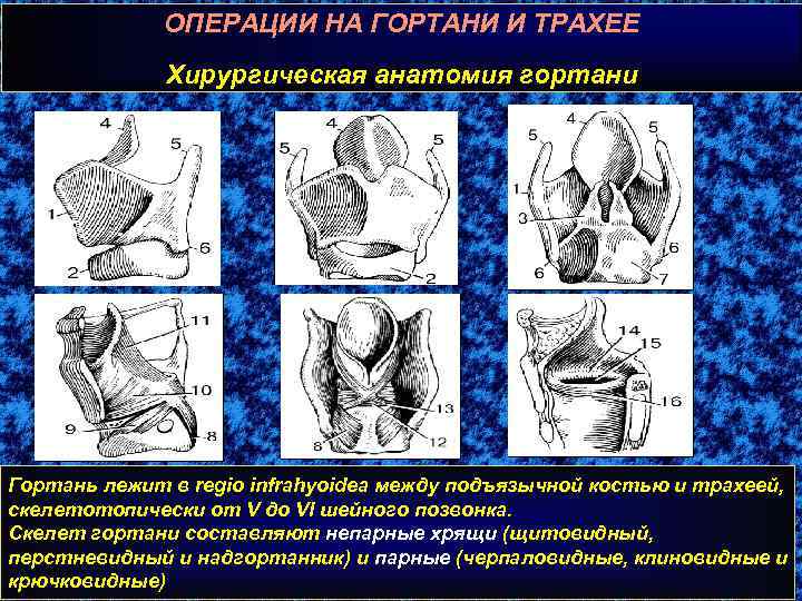 ОПЕРАЦИИ НА ГОРТАНИ И ТРАХЕЕ Хирургическая анатомия гортани Гортань лежит в regio infrahyoidea между