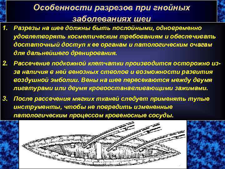 Операции на шее топографическая анатомия презентация