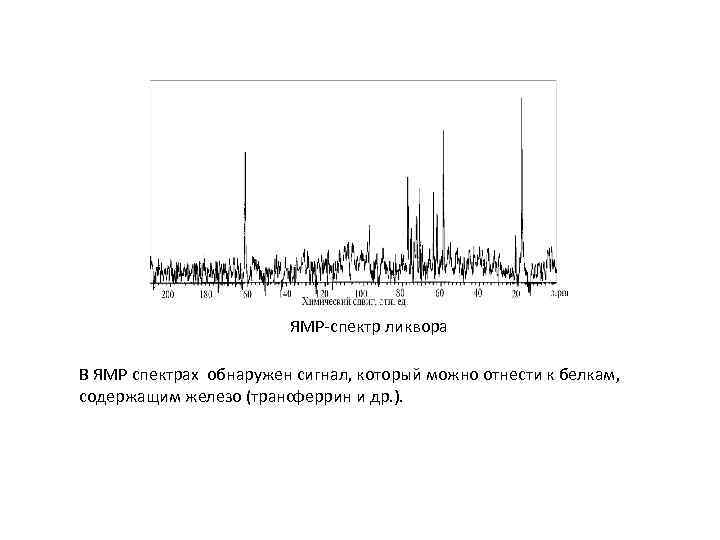 ЯМР-спектр ликвора В ЯМР спектрах обнаружен сигнал, который можно отнести к белкам, содержащим железо