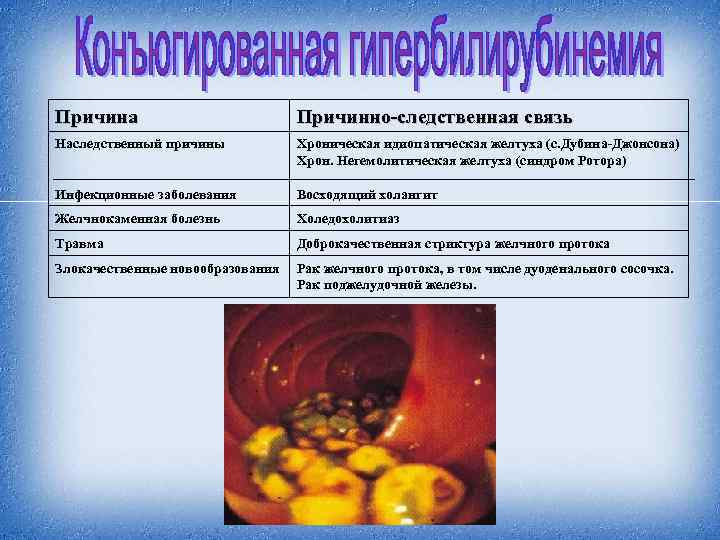 Причина Причинно-следственная связь Наследственный причины Хроническая идиопатическая желтуха (с. Дубина-Джонсона) Хрон. Негемолитическая желтуха (синдром
