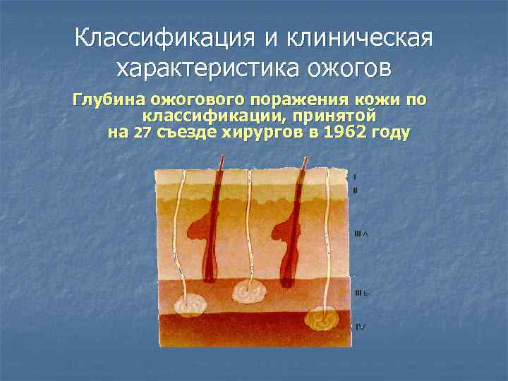 Классификация и клиническая характеристика ожогов Глубина ожогового поражения кожи по классификации, принятой на 27