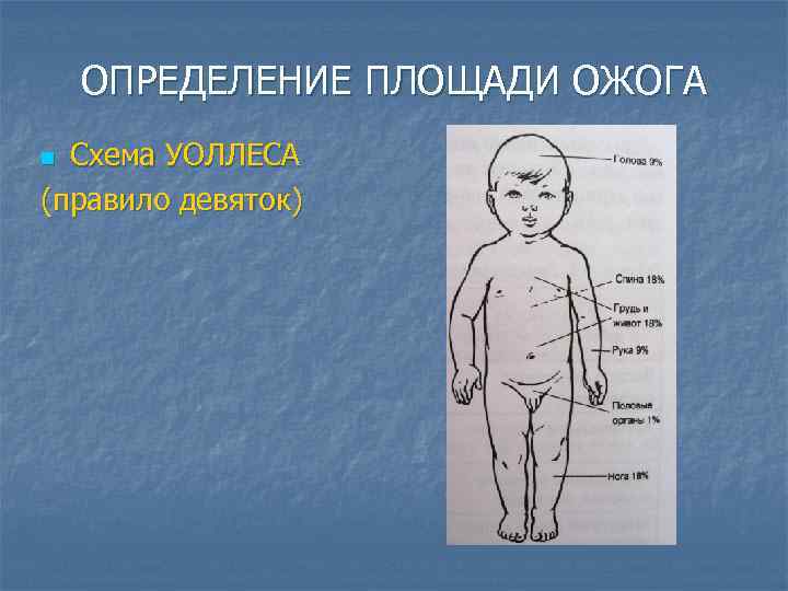 ОПРЕДЕЛЕНИЕ ПЛОЩАДИ ОЖОГА Схема УОЛЛЕСА (правило девяток) n 