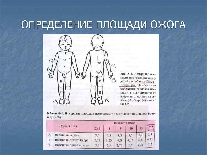 ОПРЕДЕЛЕНИЕ ПЛОЩАДИ ОЖОГА 