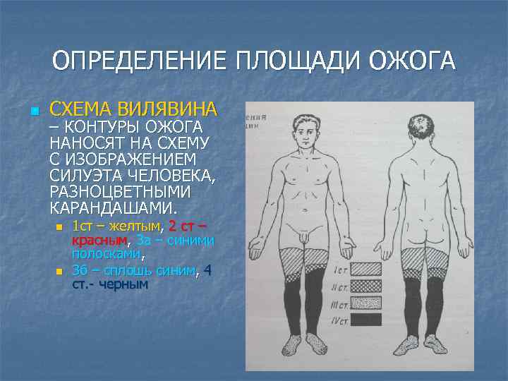 ОПРЕДЕЛЕНИЕ ПЛОЩАДИ ОЖОГА n СХЕМА ВИЛЯВИНА – КОНТУРЫ ОЖОГА НАНОСЯТ НА СХЕМУ С ИЗОБРАЖЕНИЕМ