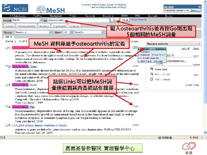 鍵入osteoarthritis後再按Go則出現 5個相關的Me. SH詞彙 Me. SH 資料庫給予osteoarthritis的定義 點選Links可以把Me. SH詞 彙連結到其內各網站作搜尋 嘉義基督教醫院 實證醫學中心 