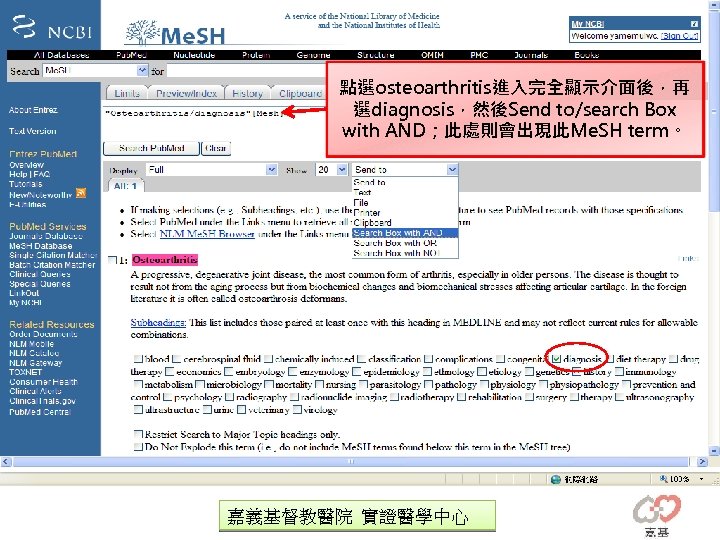 點選osteoarthritis進入完全顯示介面後，再 選diagnosis，然後Send to/search Box with AND；此處則會出現此Me. SH term。 嘉義基督教醫院 實證醫學中心 
