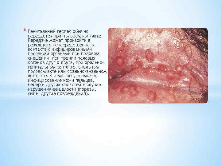 * Генитальный герпес обычно передается при половом контакте. Передача может произойти в результате непосредственного