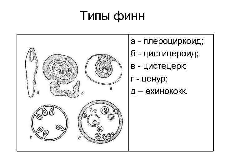 Типы финн а плероциркоид; б цистицероид; в цистецерк; г ценур; д – ехинококк. 