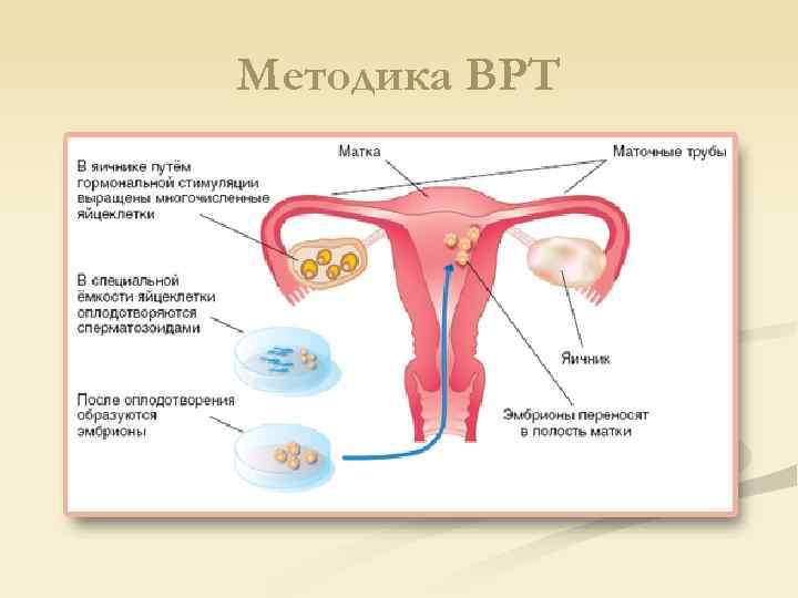 Методика ВРТ 
