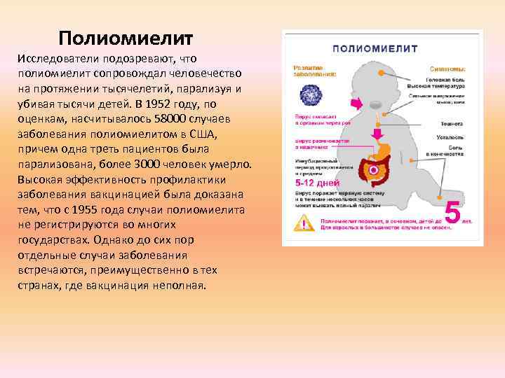 Полиомиелит Исследователи подозревают, что полиомиелит сопровождал человечество на протяжении тысячелетий, парализуя и убивая тысячи