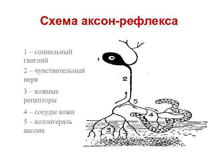 Схема аксон-рефлекса 1 – спинальный ганглий 2 – чувствительный нерв 3 – кожные рецепторы