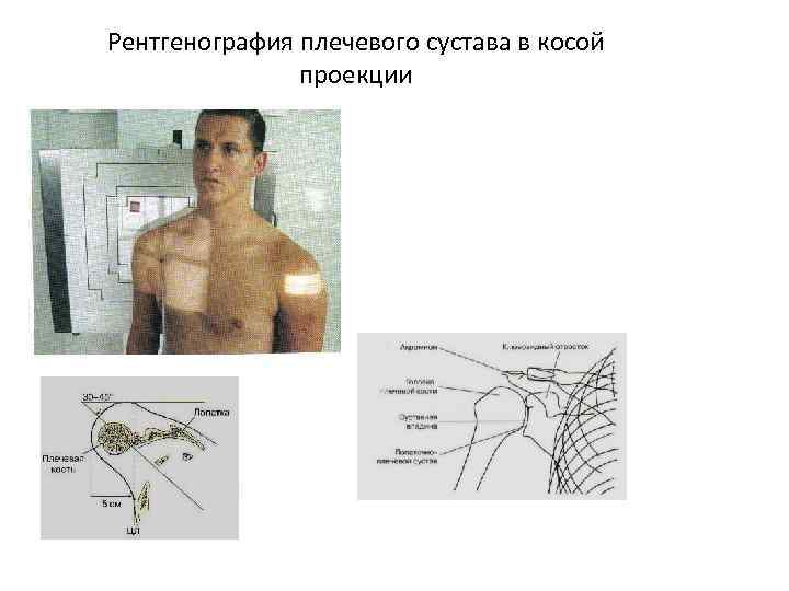 Перелом плеча карта вызова скорой медицинской