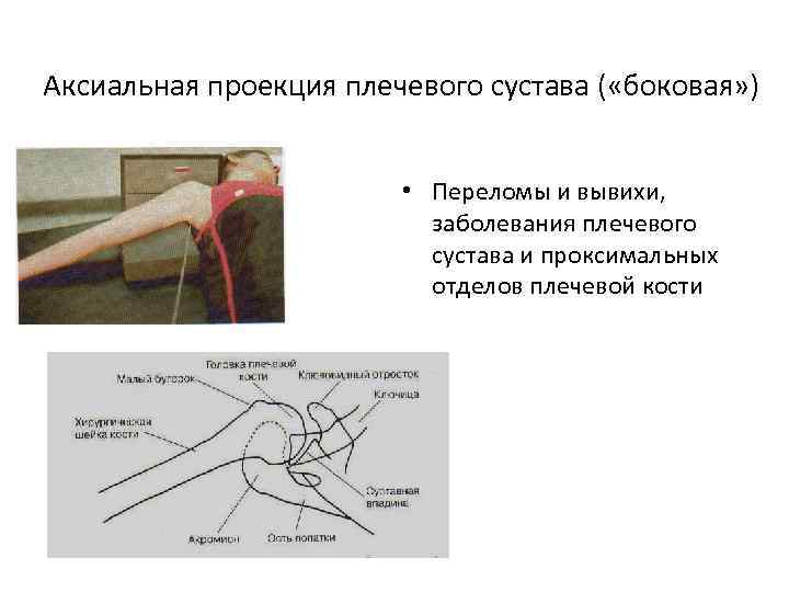 Рентгеновская картина переломов и вывихов костей