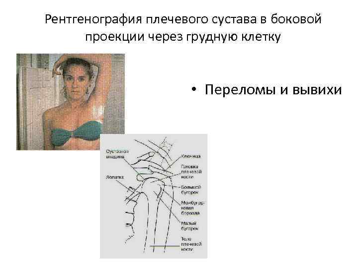 Ключица укладка. Плечевой сустав в боковой проекции рентген.