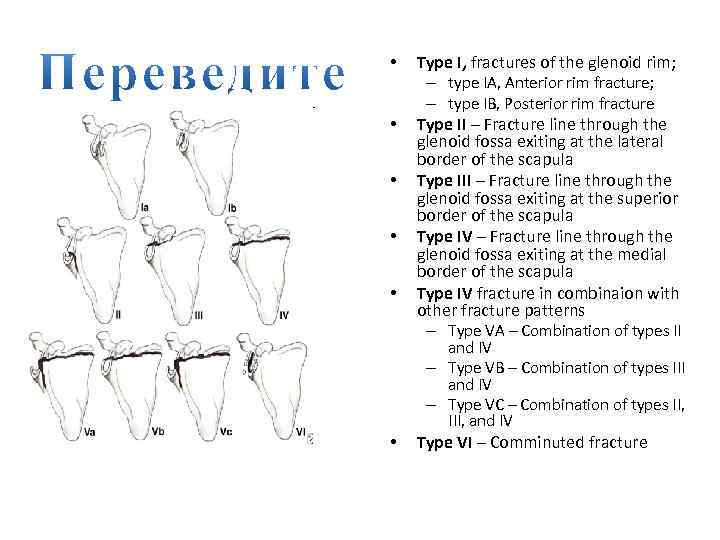 Классификация переломов лопатки рисунок