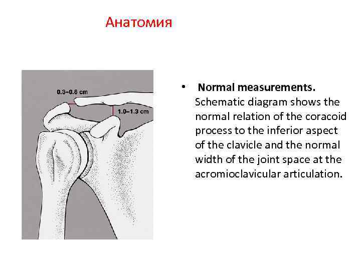 Анатомия • Normal measurements. Schematic diagram shows the normal relation of the coracoid process