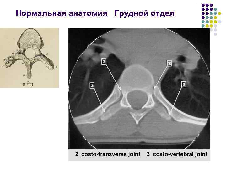 Нормальная анатомия Грудной отдел 
