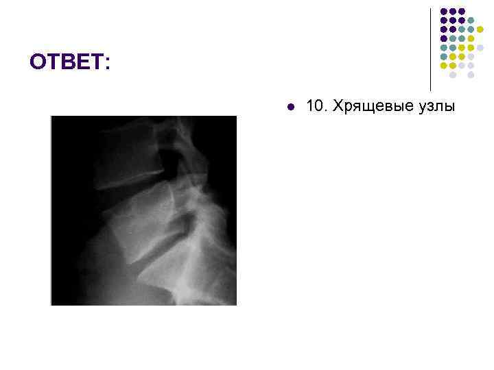 ОТВЕТ: l 10. Хрящевые узлы 