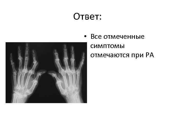 Ответ: • Все отмеченные симптомы отмечаются при РА 