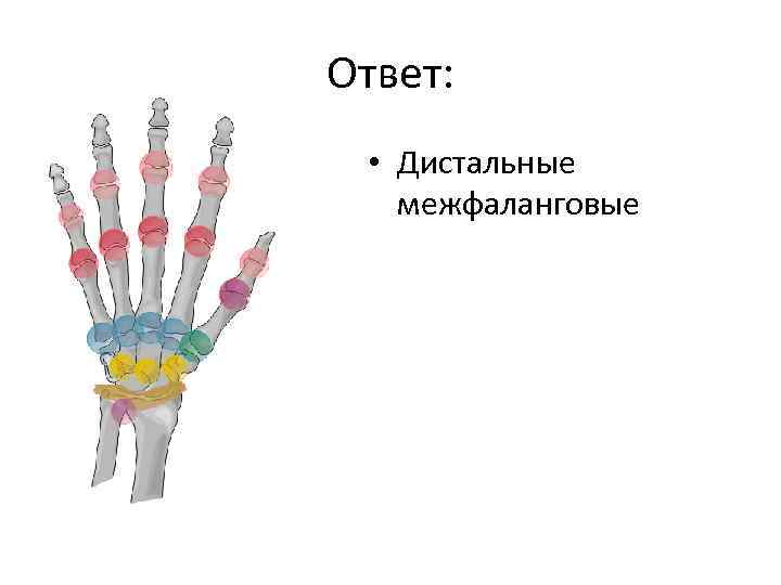 Ответ: • Дистальные межфаланговые 