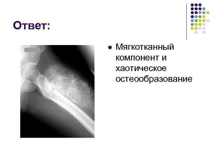 Ответ: l Мягкотканный компонент и хаотическое остеообразование 