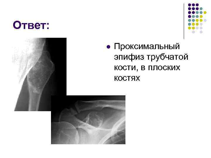 Ответ: l Проксимальный эпифиз трубчатой кости, в плоских костях 