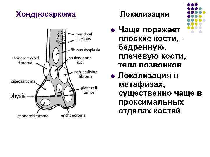 Хондросаркома Локализация l l Чаще поражает плоские кости, бедренную, плечевую кости, тела позвонков Локализация