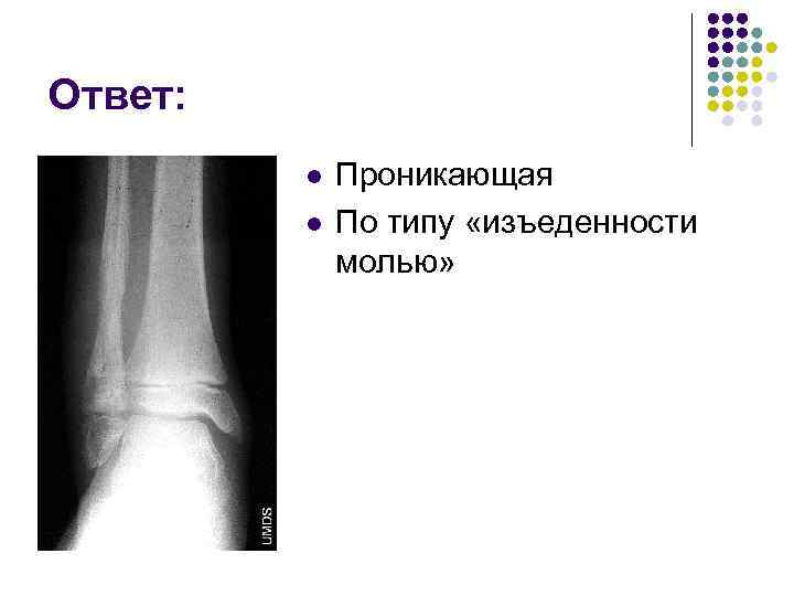 Ответ: l l Проникающая По типу «изъеденности молью» 