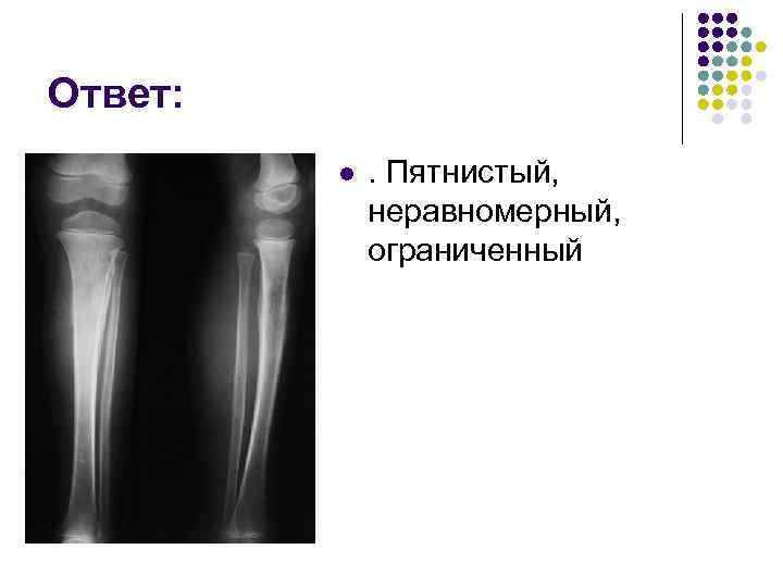 Ответ: l . Пятнистый, неравномерный, ограниченный 