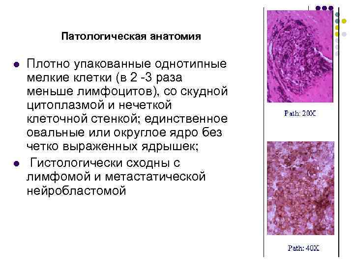 Патологическая анатомия картинки