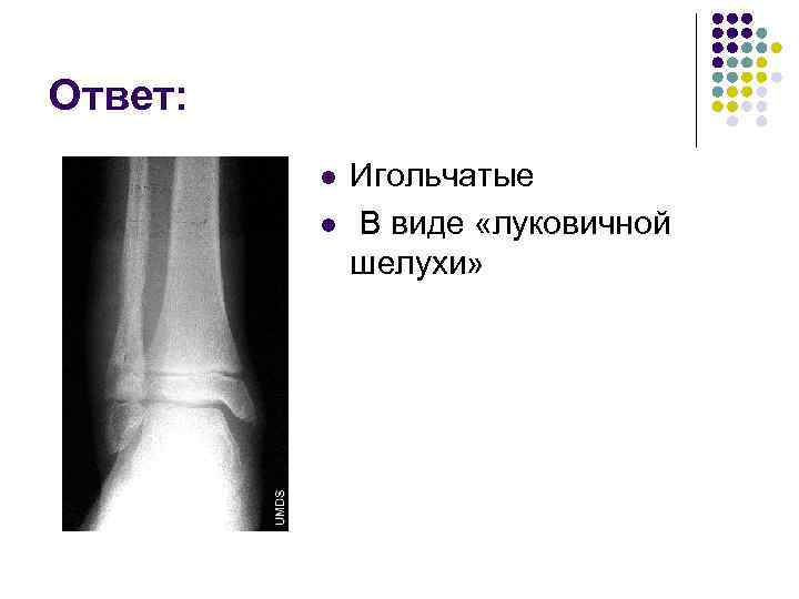 Ответ: l l Игольчатые В виде «луковичной шелухи» 