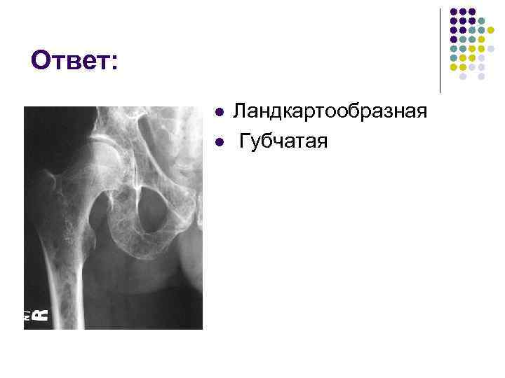 Ответ: l l Ландкартообразная Губчатая 