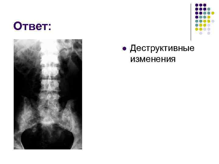 Ответ: l Деструктивные изменения 