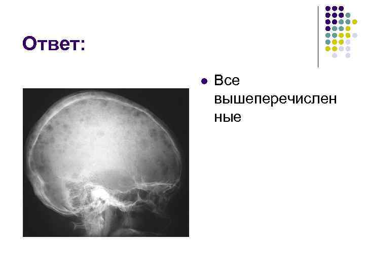 Ответ: l Все вышеперечислен ные 