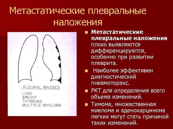 Метастатические плевральные наложения n n Метастатические плевральные наложения плохо выявляются дифференцируются, особенно при развитии