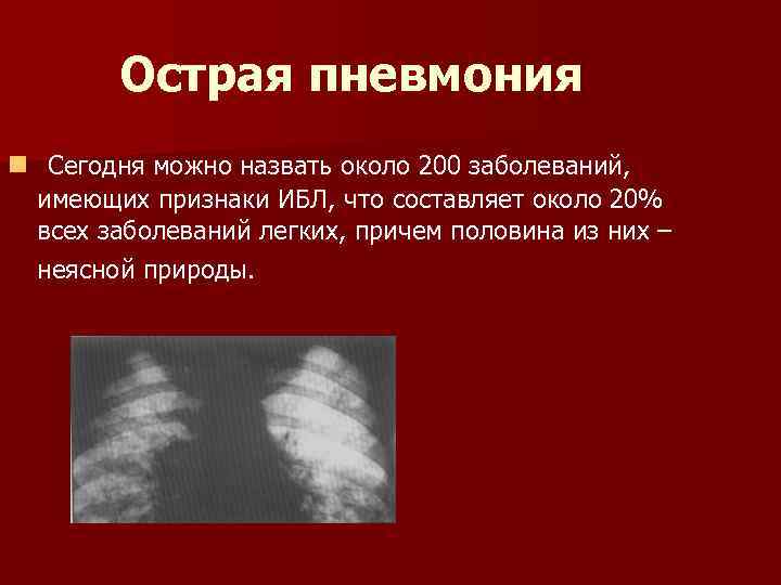 Острая пневмония n Сегодня можно назвать около 200 заболеваний, имеющих признаки ИБЛ, что составляет