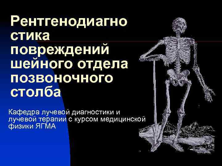 Рентгенодиагно стика повреждений шейного отдела позвоночного столба Кафедра лучевой диагностики и лучевой терапии с