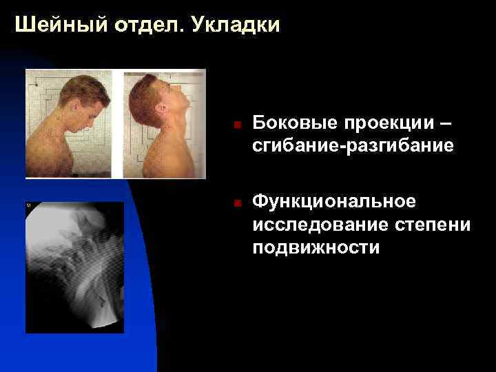 Шейный отдел. Укладки n n Боковые проекции – сгибание-разгибание Функциональное исследование степени подвижности 