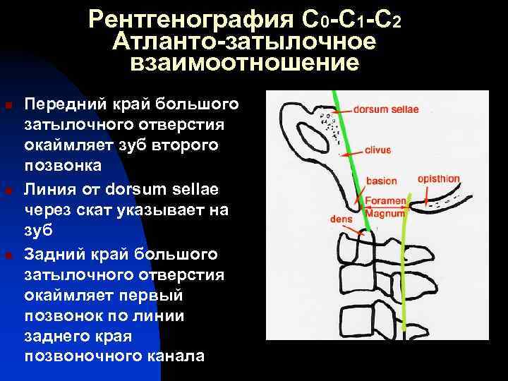 Рентгенография С 0 -С 1 -С 2 Атланто-затылочное взаимоотношение n n n Передний край