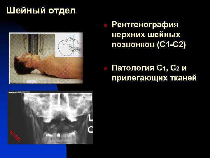 Рентгенография с прямым увеличением изображения может использоваться только при наличии специальных