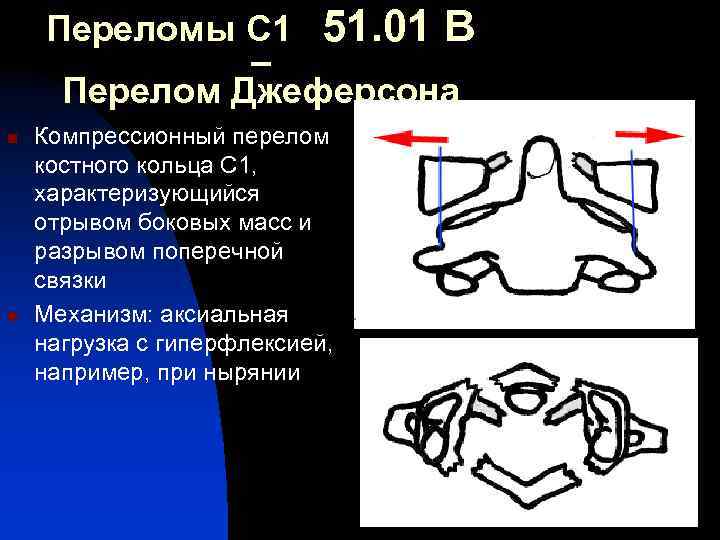 Переломы С 1 51. 01 В – Перелом Джеферсона n n Компрессионный перелом костного