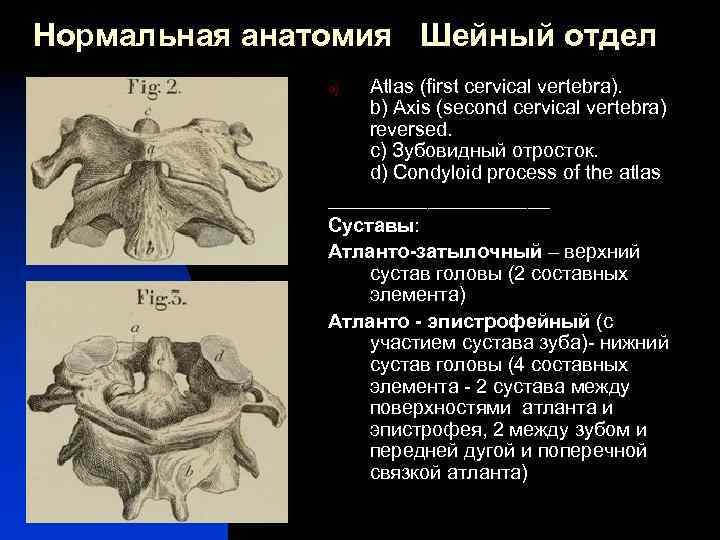 Нормальная анатомия Шейный отдел Atlas (first cervical vertebra). b) Axis (second cervical vertebra) reversed.