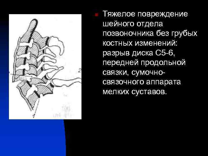 Повреждение шейного отдела позвоночника