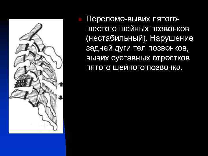 Вывих шейного позвонка карта вызова