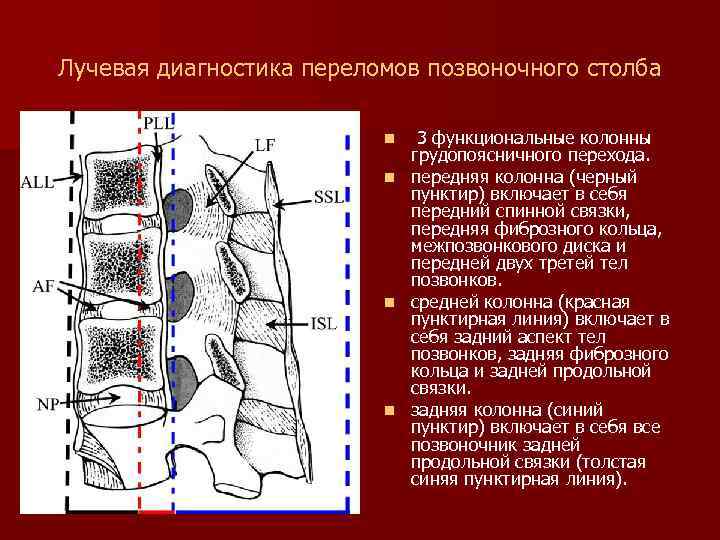 Лучевая диагностика переломов позвоночного столба 3 функциональные колонны грудопоясничного перехода. n передняя колонна (черный