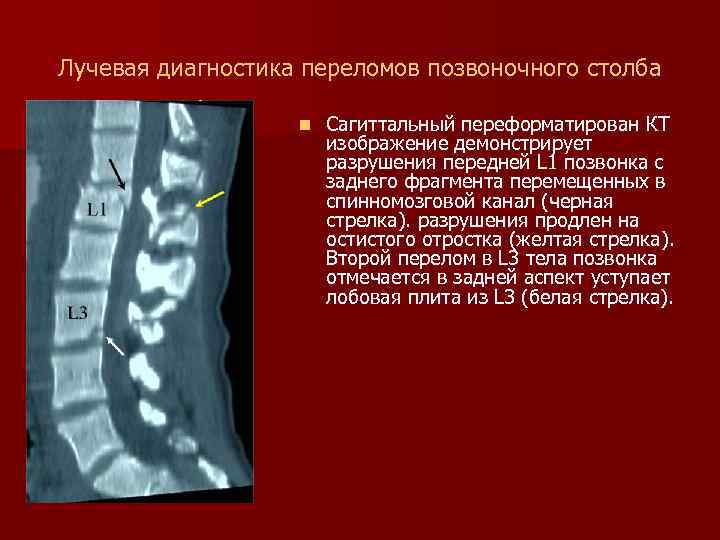 Лучевая диагностика костей презентация