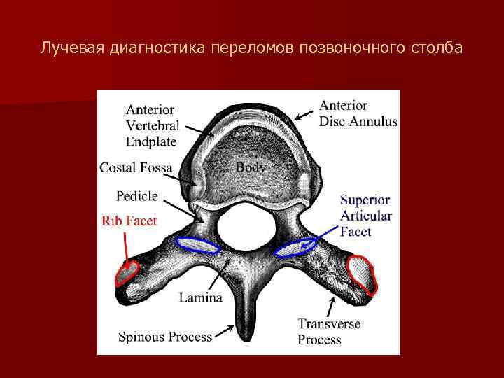 Лучевая диагностика переломов позвоночного столба 
