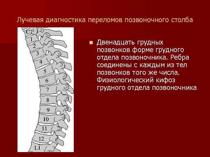 Лучевая диагностика переломов позвоночного столба n Двенадцать грудных позвонков форме грудного отдела позвоночника. Ребра