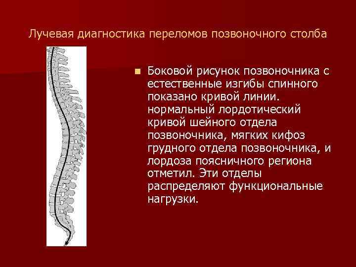 Лучевая диагностика переломов позвоночного столба n Боковой рисунок позвоночника с естественные изгибы спинного показано