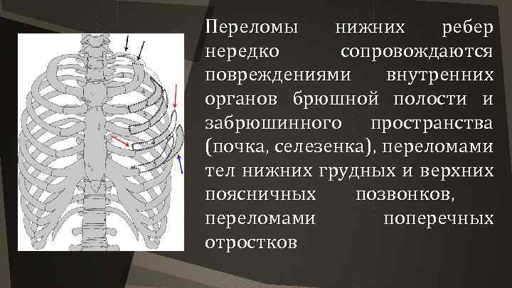 Переломы нижних ребер нередко сопровождаются повреждениями внутренних органов брюшной полости и забрюшинного пространства (почка,